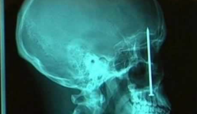 Kinect for surgery? It’s more likely, and safer, than you think