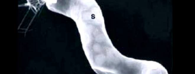 Breakthrough: NASA discovers proof of alternative life