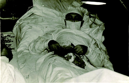 Soviet surgeon removes his own appendix in Antarctica, 1961