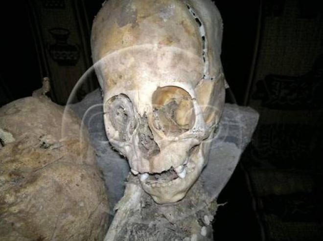 Scientists think this triangular skull belongs to an alien
