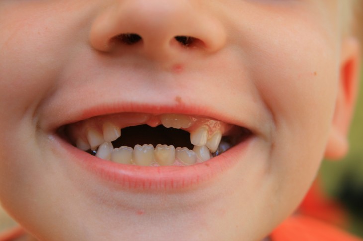 This guy built a machine to transport his kids’ teeth straight to the tooth fairy