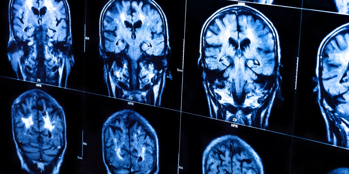 Scientists can make copies of memories. Here’s what that might mean